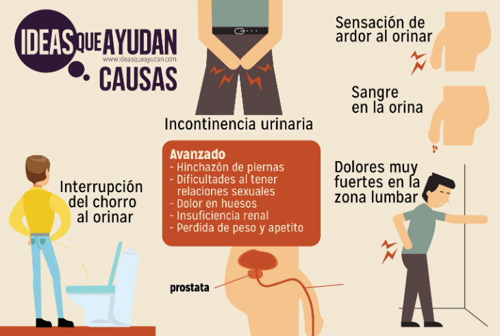 cancer de prostata sintomas español)