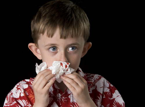 Aprende a frenar las hemorragias nasales