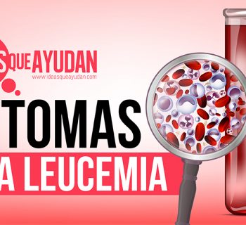 Síntomas de la leucemia