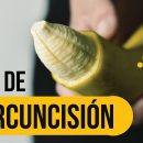 saber de la circuncisión