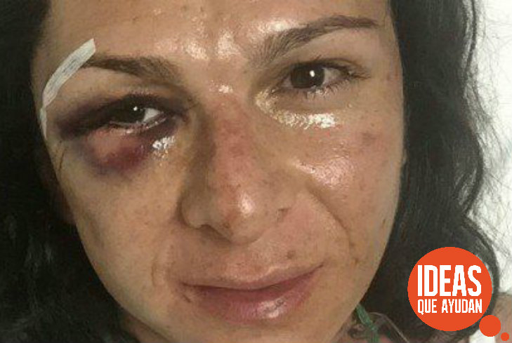 Ana Gabriela Guevara, sufre agresión en accidente #NoIgnoresLaViolencia #NiUnaMenos