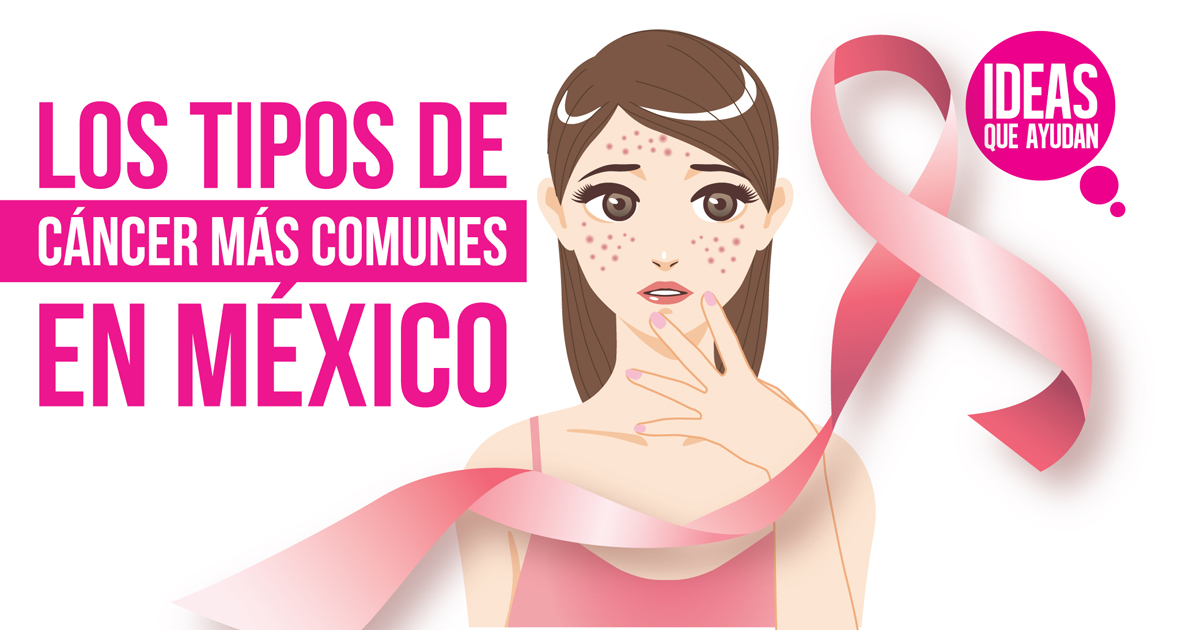Los tipos de cáncer más comunes en México