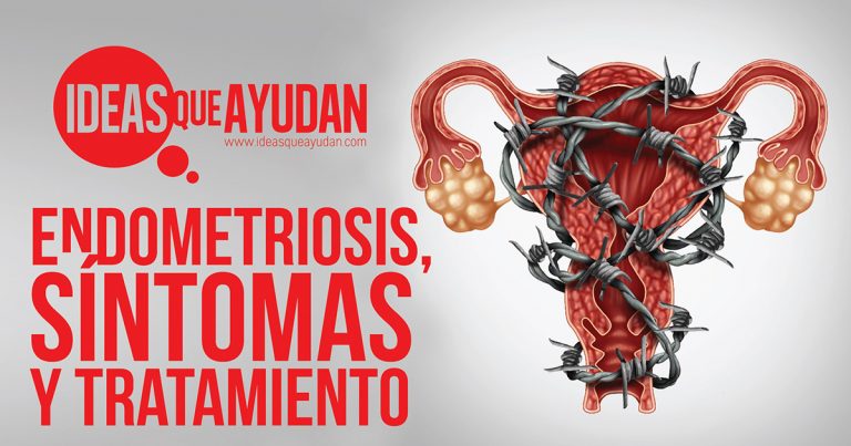 Endometriosis Síntomas Y Tratamiento En Ideas Que Ayudan 7814