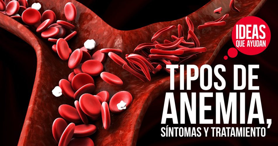 Tipos De Anemia Síntomas Y Tratamiento Ideas Que Ayudan 