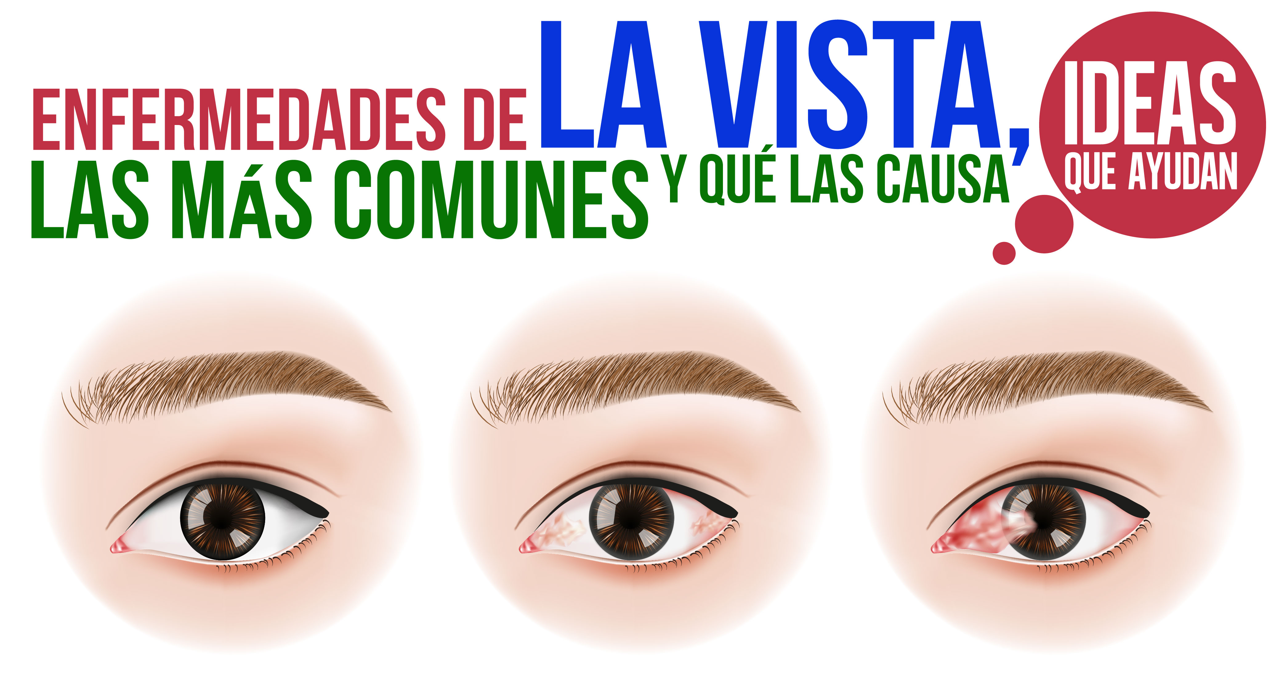 Enfermedades de la vista más comunes y qué las causa
