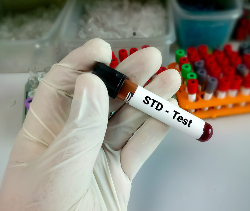 ¿Cómo detectar una enfermedad de transmisión sexual (ETS)?