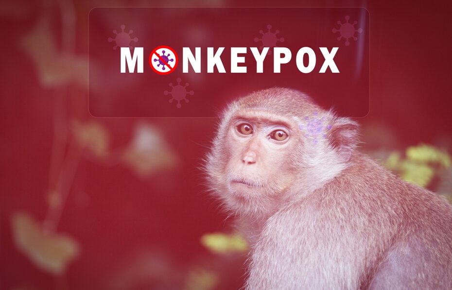 ¿Cómo saber si mi pareja sexual tiene la viruela del mono?