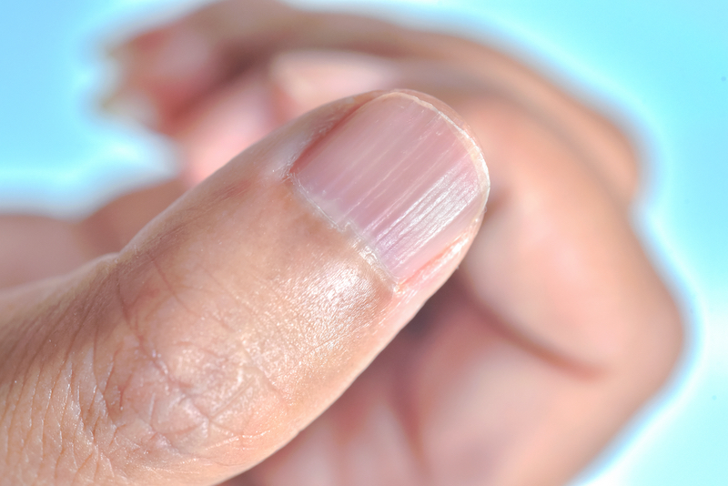 ¿Por qué salen líneas onduladas en las uñas? estas son las posibles causas